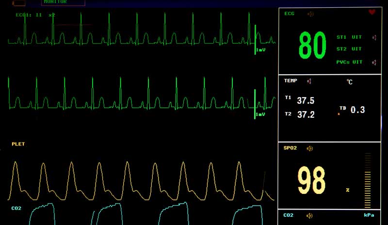 electrocardiogram screen